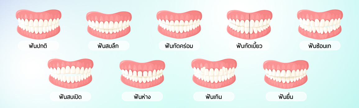 ปัญหาฟัน (tooth-problems)