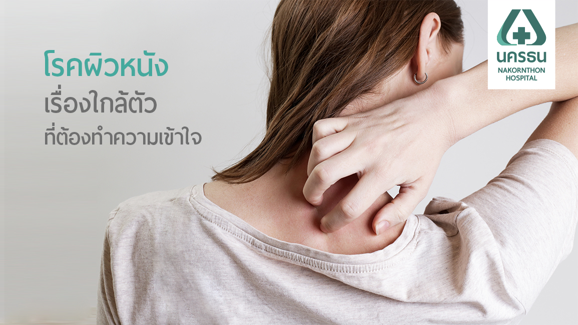 ทำความรู้จักกับโรคผิวหนังกันเถอะ