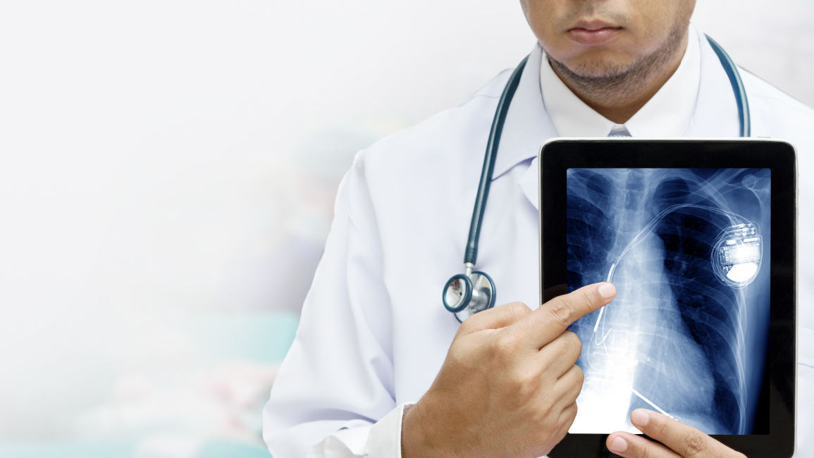 การใส่เครื่องกระตุ้นไฟฟ้าหัวใจ การใส่เครื่องกระตุ้นไฟฟ้าหัวใจ